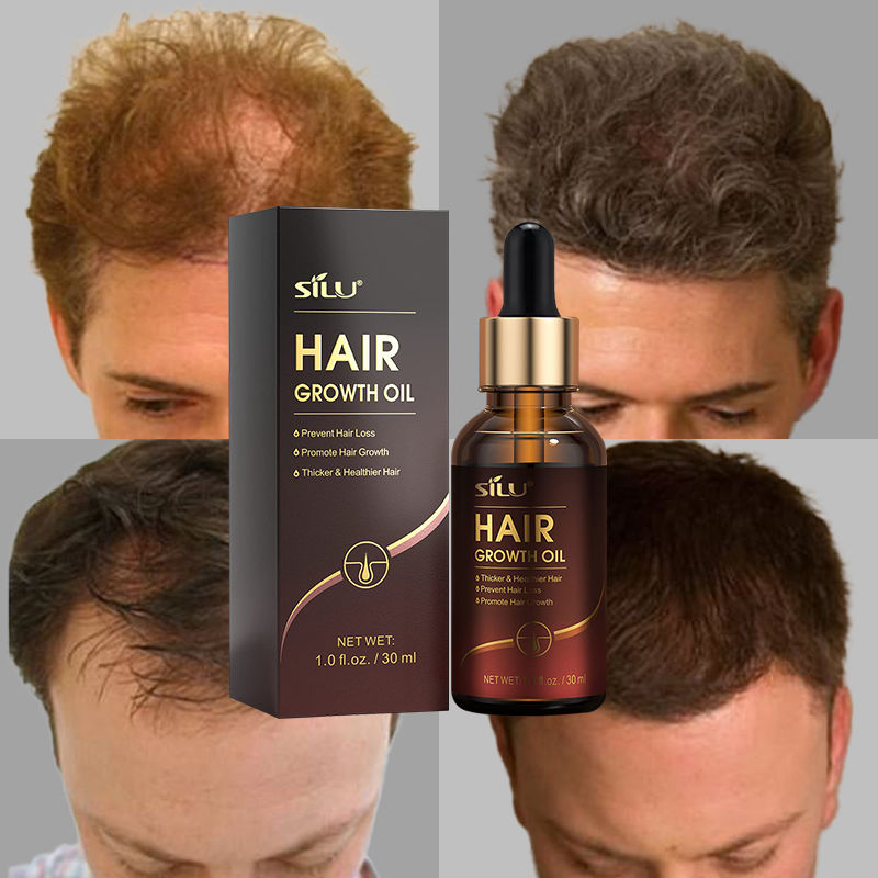 OEM best castor rosemary onion hair growth oil
