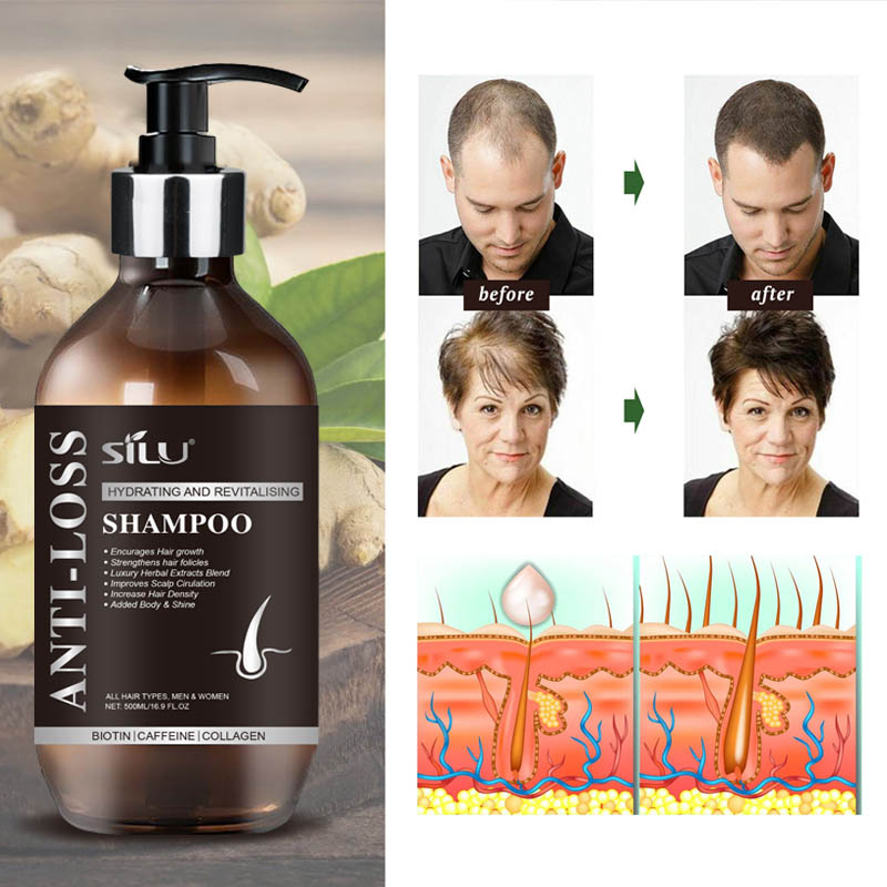 Anti Hair Loss Ginger Hair Growth Shampoo And Conditioner Set